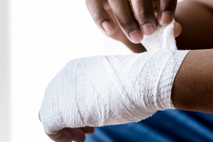 arm accident